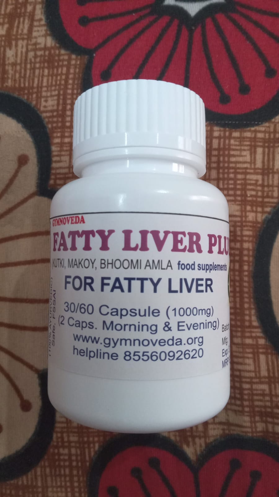 fatty liver